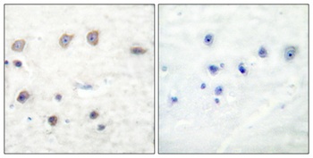Adducin α/β (phospho Ser726/713) rabbit pAb