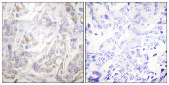 Cytokeratin 18 (phospho Ser33) rabbit pAb