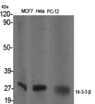 14-3-3 β rabbit pAb Antibody