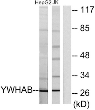 14-3-3 β rabbit pAb Antibody