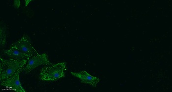 17β-HSD11 rabbit pAb Antibody