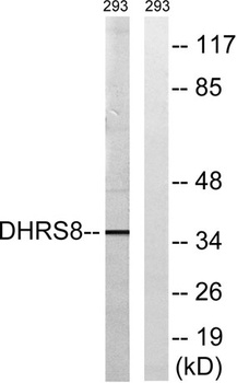17β-HSD11 rabbit pAb Antibody
