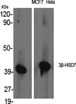 3β-HSD7 rabbit pAb Antibody
