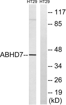 ABHD7 rabbit pAb Antibody