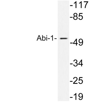 Abi-1 rabbit pAb Antibody