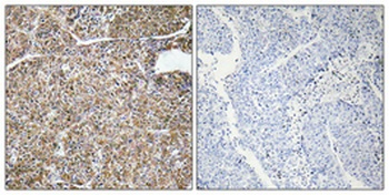 ACBP rabbit pAb Antibody