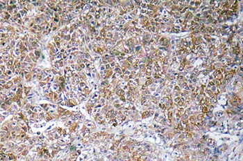 ACBP rabbit pAb Antibody