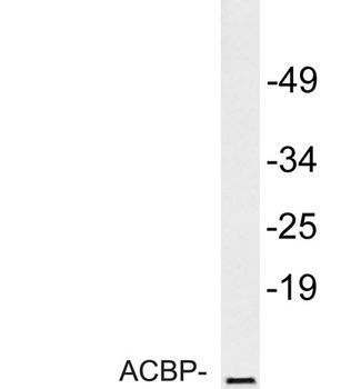 ACBP rabbit pAb Antibody