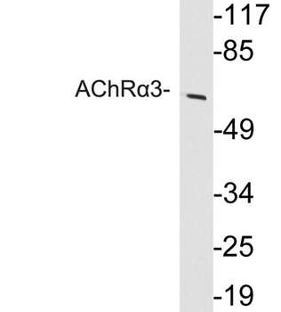 AChRα3 rabbit pAb Antibody