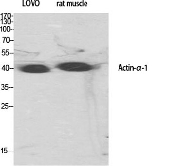 Actin α1 rabbit pAb Antibody