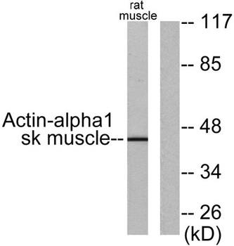 Actin α1 rabbit pAb Antibody