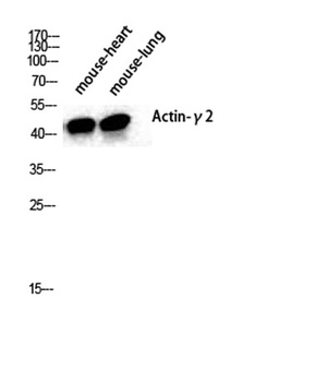 Actin α3 rabbit pAb Antibody
