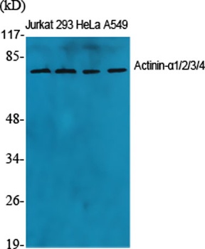Actinin-α1/2/3/4 rabbit pAb Antibody