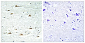 Actinin-α1/2/3/4 rabbit pAb Antibody