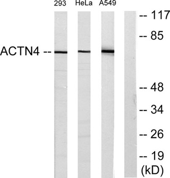 Actinin-α1/2/3/4 rabbit pAb Antibody