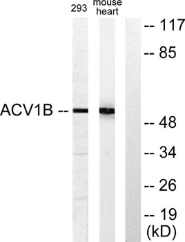 ACTR-IB rabbit pAb Antibody