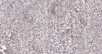 ADAR2 rabbit pAb Antibody