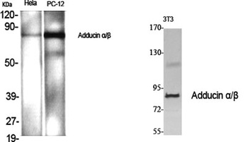 Adducin α/β rabbit pAb Antibody