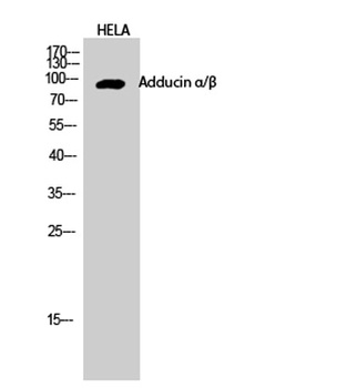 Adducin α/β rabbit pAb Antibody