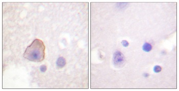 Adducin α/β rabbit pAb Antibody