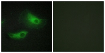 Adducin β rabbit pAb Antibody