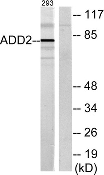 Adducin β rabbit pAb Antibody