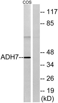 ADH7 rabbit pAb Antibody