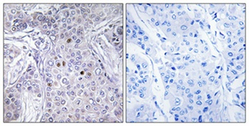 AF-10 rabbit pAb Antibody