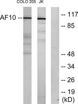AF-10 rabbit pAb Antibody