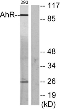 Ah Receptor rabbit pAb Antibody