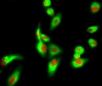 AIM2 rabbit pAb Antibody