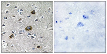 AKAP 149 rabbit pAb Antibody