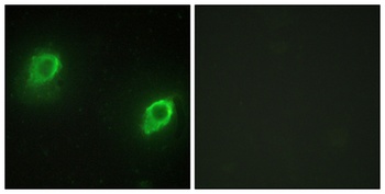 AKAP 79 rabbit pAb Antibody