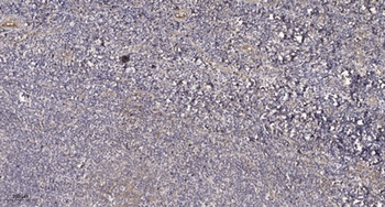 AKAP 79 rabbit pAb Antibody