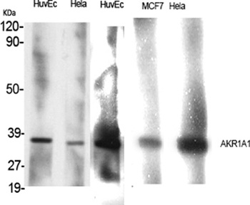 AKR1A1 rabbit pAb Antibody
