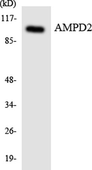 AMPD2 rabbit pAb Antibody