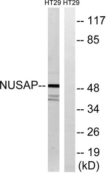 ANKT rabbit pAb Antibody