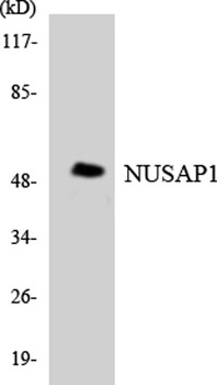 ANKT rabbit pAb Antibody