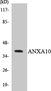 Annexin X rabbit pAb Antibody