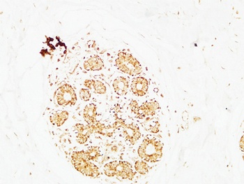 AP-2γ rabbit pAb Antibody