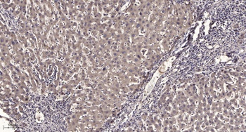 APBA2BP rabbit pAb Antibody