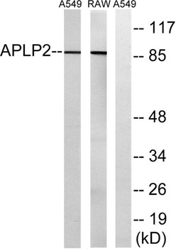 APLP-2 rabbit pAb Antibody