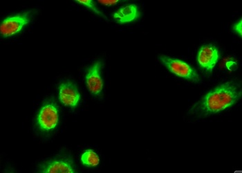 AQP2 rabbit pAb Antibody