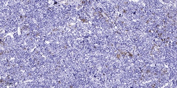 AQP2 rabbit pAb Antibody