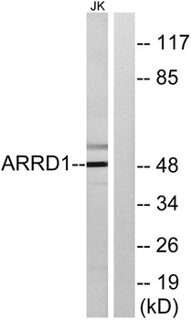 Arrdc1 rabbit pAb Antibody