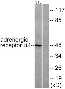 AR-β2 rabbit pAb Antibody