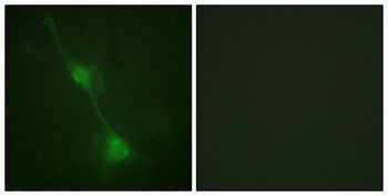 Ataxin-1 rabbit pAb Antibody