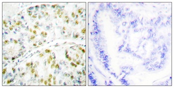 Ataxin-1 rabbit pAb Antibody