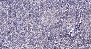 ATF-6β rabbit pAb Antibody