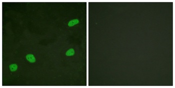 ATRIP rabbit pAb Antibody